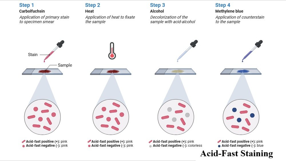 Acid-Fast Staining Procedure