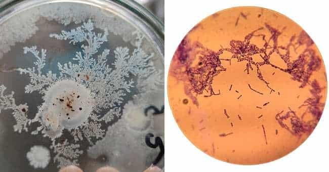 Bacillus subtilis