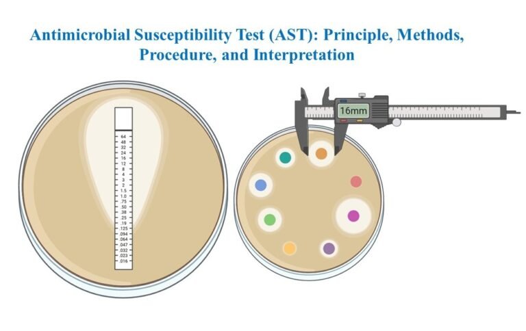 Antimicrobial Susceptibility Test (AST): Principle, Methods, Procedure, and Interpretation 8 Antimicrobial Susceptibility Test (AST) Principle, Methods, Procedure, and Interpretation
