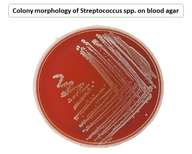 Colony morphology of Streptococcus spp. on blood agar