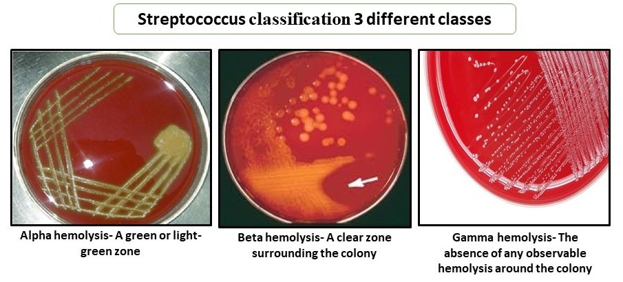 Streptococcus classification 3 different classes